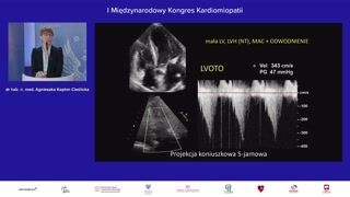 Kardiomiopatia przerostowa koniuszkowa i ocena koniuszka