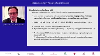 Diagnostyka obrazowa: rezonans i tomografia serca