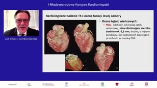 Wykrycie odejścia lewej tętnicy wieńcowej od pnia płucnego (zespół Blanda-Wight-Garlanda) i dalsze leczenie