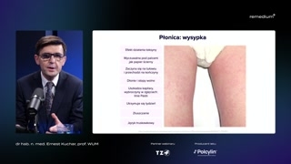 Płonica i potwierdzanie rozpoznania