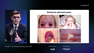 Herpangina, opryszczka i inne wirusowe zespoły