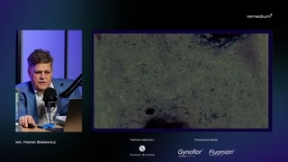 Biocenoza w granicach normy i decyzje terapeutyczne