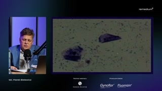 Biocenoza graniczna i leczenie — przypadki kliniczne
