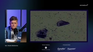 Biocenoza nieprawidłowa i patologiczna — terapie