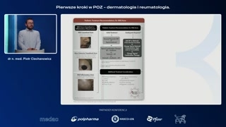 Strategie leczenia według nasilenia i wnioski