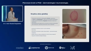 Grzybice skóry gładkiej i łupież pstry