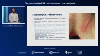 Diagnostyka i różnicowanie pokrzywki