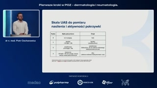 Leczenie: zalecenia ogólne, leki przeciwhistaminowe i omalizumab