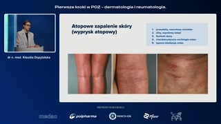 Czynniki genetyczne i mechanizmy immunologiczne
