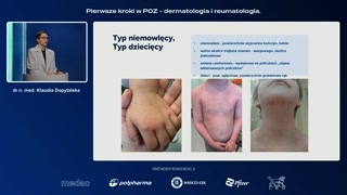 Lokalizacja zmian według wieku i cechy szczególne