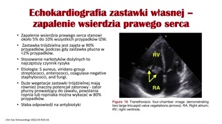 Ultrasonografia, doppler i tomografia serca