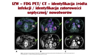 Rola rezonansu magnetycznego i zalecenia praktyczne