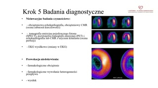 Wybór badań nieinwazyjnych i tomografia tętnic wieńcowych