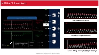Impella prawostronna, SmartAssist i Impella Connect