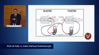 ECMO i zewnętrzne komory sztuczne (Berlin Heart, PolVAD)