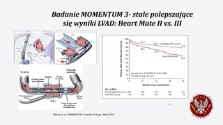 HeartMate 3: budowa, implantacja i wyniki badań MOMENTUM