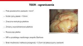 Wtórna niedomykalność mitralna, kryteria kwalifikacji i bioprotezy