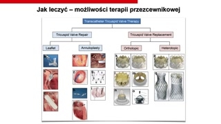 Niedomykalność trójdzielna: naprawy brzeg do brzegu i alternatywy