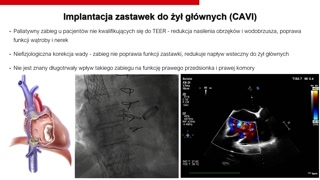 Implantacja zastawek do żył głównych, perspektywy bioprotez i podsumowanie