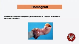 Homografty i przyczyny chorób zastawki mitralnej