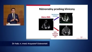 Ciężkość choroby i rozpoznanie