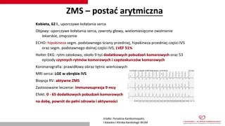 Przypadki kliniczne i efekty leczenia immunosupresyjnego