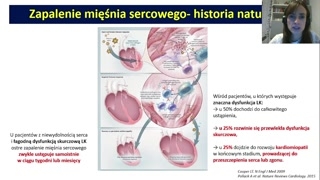 Historia naturalna i definicja kardiomiopatii rozstrzeniowej