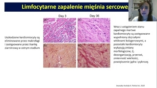 Patofizjologia i rola układu immunologicznego oraz wnioski kliniczne