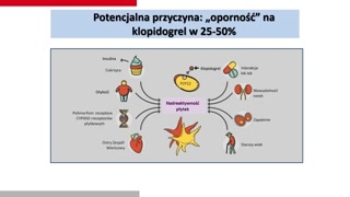 Nieprzewidywalność Klopidogrelu i rekomendacje wytycznych