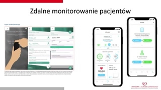 Usuwanie elektrod i wprowadzenie telemonitoringu