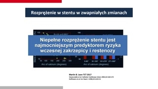 Leczenie zwapnień, litotrypsja wewnątrznaczyniowa oraz zabiegi strukturalne serca