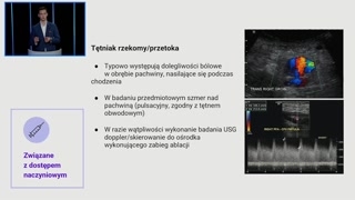 Diagnostyka powikłań pachwiny i rola USG