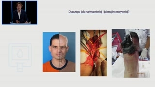 Powikłania naczyniowe i znaczenie diagnostyki