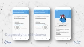 Wprowadzenie i mechanizm działania trazodonu