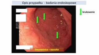 Endoskopia, histopatologia i diagnostyka wątroby