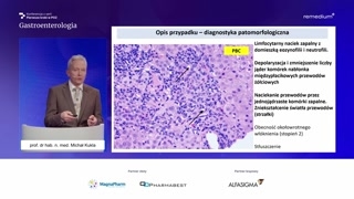 Pierwotne zapalenie dróg żółciowych: rozpoznanie i związek z celiakią