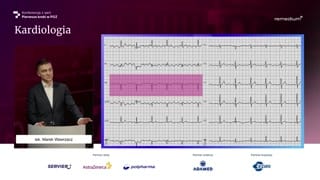Artefakty i fałszywe migotanie przedsionków