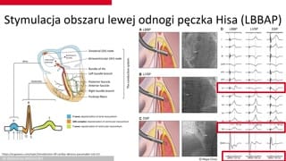 Przygotowanie, ryzyka i stymulacja fizjologiczna