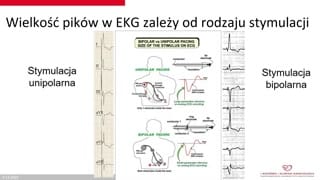 Rozpoznawanie nieprawidłowości EKG i konsultacja