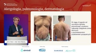 Pęcherzyca paraneoplastyczna i powiązania z nowotworami