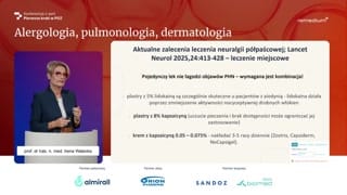 Półpasiec, leczenie i zapobieganie neuralgii popółpaścowej