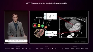 Podstawy różnicowania pochodzenia arytmii na EKG