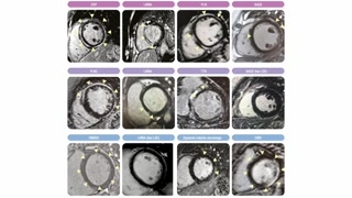 Wywiad i kliniczne czerwone flagi