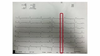 Rola ECHO, rezonansu magnetycznego i badań genetycznych