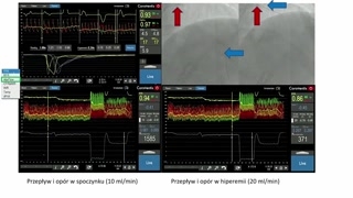 Metody termodilucji i pomiary ciągłe mikrokrążenia