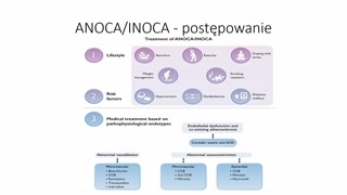 Leczenie farmakologiczne i zabiegowe (reduktor przepływu)