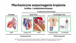 Przegląd urządzeń i kontrapulsacja wewnątrzaortalna