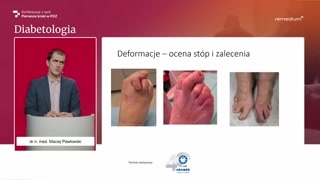 Polineuropatia: objawy, urazy i opieka profilaktyczna