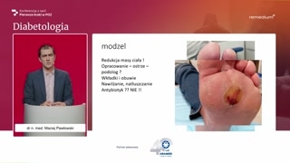 Owrzodzenia neuropatyczne: powstawanie, odciążenie i antybiotykoterapia