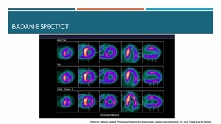 Ocena wyników: skala Peruginiego i wskaźnik serce–płuco